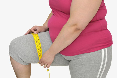 причины возникновения варикоза ожирение